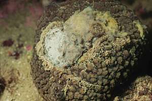 grey nipple sponge with bacterial infection
