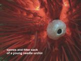 spines and filter sack of a young needle urchin
